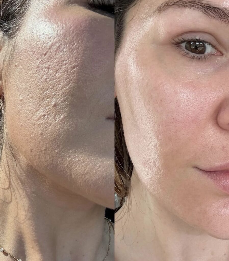 Skin Booster