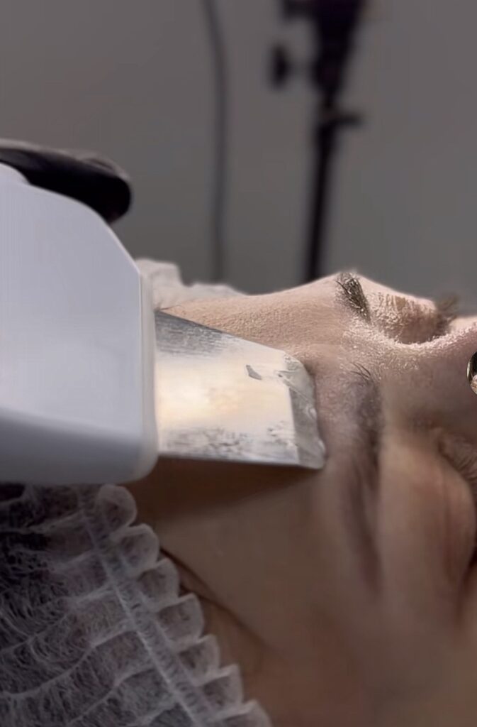Ultrasound Facial