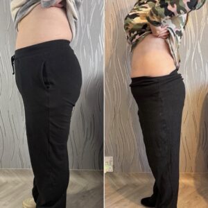 Fat Dissolve - No Needle